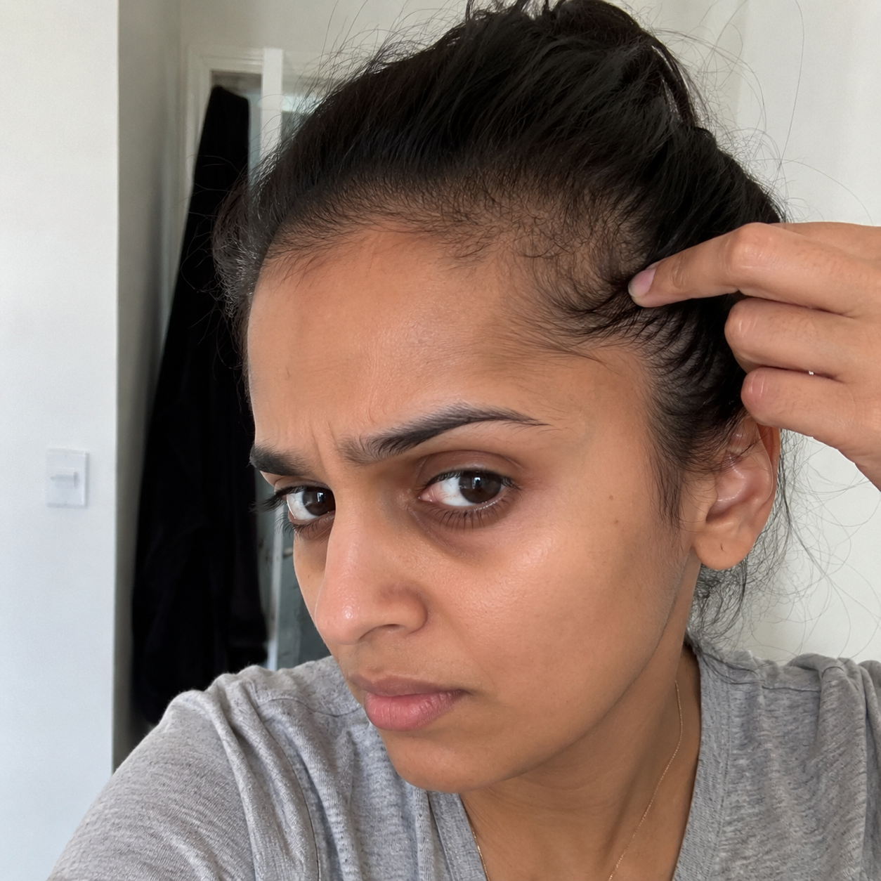 Thinning edges, temples & hairline